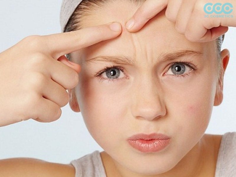 Mách nhỏ bạn những lưu ý khi chăm sóc da mụn hiệu quả