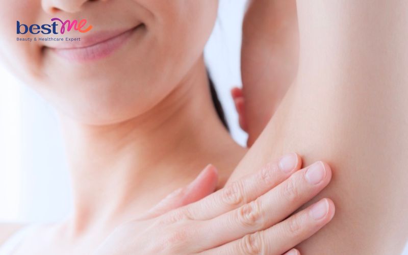u-ba-dau-o-nach-hinh-anh-nguyen-nhan-va-cach-tri-hieu-qua-8 U bã đậu ở nách: Hình ảnh, nguyên nhân và cách trị hiệu quả - 8