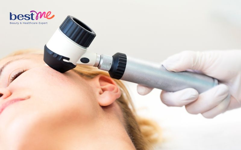 uong-khang-sinh-bi-noi-mun-nguyen-nhan-va-cach-xu-ly-tot-nhat-5 Uống kháng sinh bị nổi mụn: Nguyên nhân và cách xử lý tốt nhất - 5