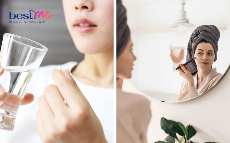 uong-khang-sinh-bi-noi-mun-nguyen-nhan-va-cach-xu-ly-tot-nhat-6 Uống kháng sinh bị nổi mụn: Nguyên nhân và cách xử lý tốt nhất - 6