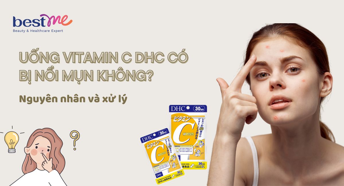 Uống vitamin C DHC có bị nổi mụn không? Nguyên nhân và xử lý