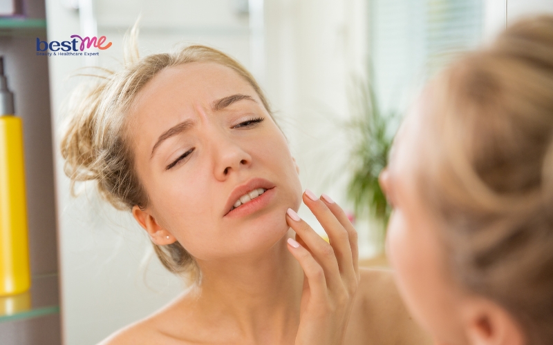 vet-thuong-vet-seo-bi-noi-mun-nuoc-phai-lam-sao-de-khac-phuc-1 Vết thương, vết sẹo bị nổi mụn nước phải làm sao để khắc phục? - 1