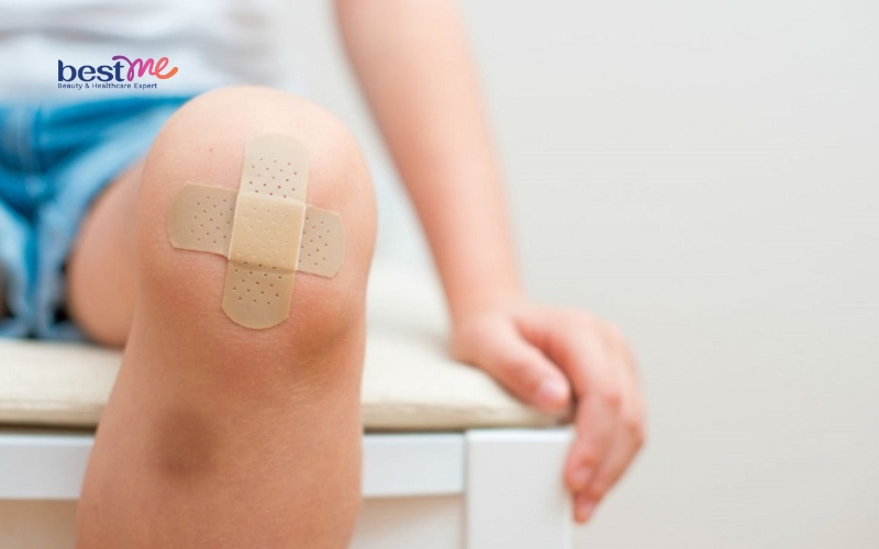 vet-thuong-vet-seo-bi-noi-mun-nuoc-phai-lam-sao-de-khac-phuc-4 Vết thương, vết sẹo bị nổi mụn nước phải làm sao để khắc phục? - 4