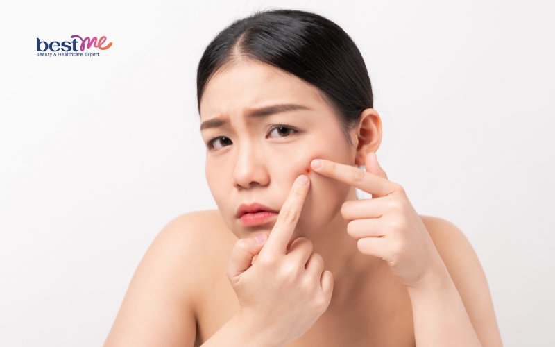 vet-thuong-vet-seo-bi-noi-mun-nuoc-phai-lam-sao-de-khac-phuc-5 Vết thương, vết sẹo bị nổi mụn nước phải làm sao để khắc phục? - 5