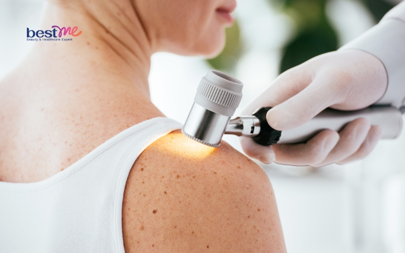 vet-thuong-vet-seo-bi-noi-mun-nuoc-phai-lam-sao-de-khac-phuc-6 Vết thương, vết sẹo bị nổi mụn nước phải làm sao để khắc phục? - 6