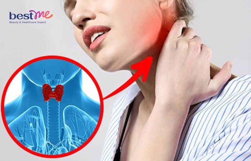 Thuốc giảm cân gây rối loạn chức năng tuyến giáp