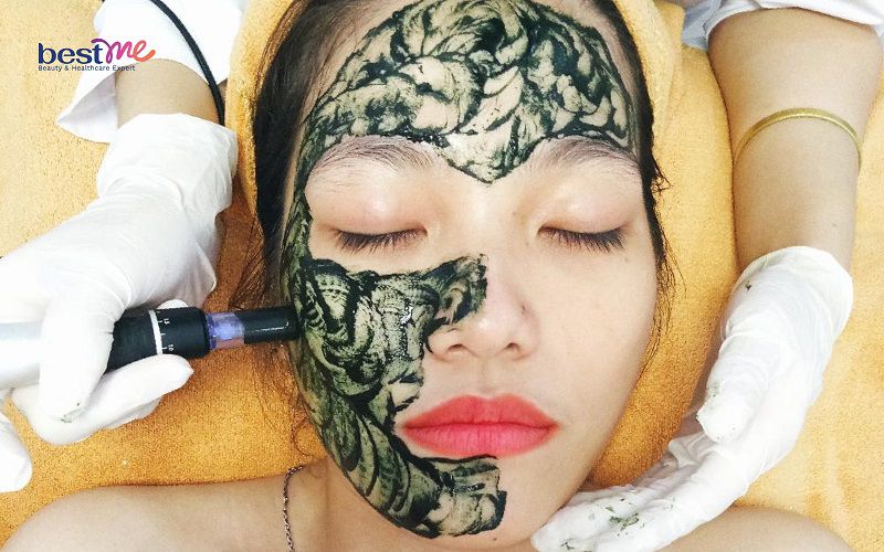 Bước quan trọng nhất trong quá trình cấy tảo da mặt