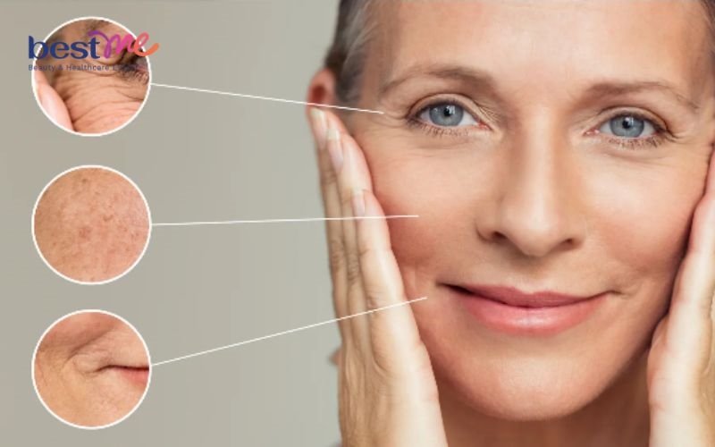 Vitamin B2 trong viên cấp nước duy trì độ ẩm, ngăn da khô
