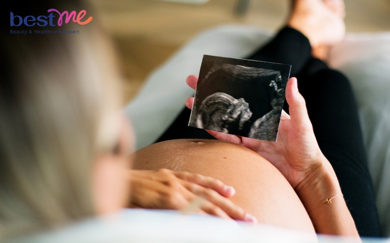 cach-uong-vitamin-bau-pregnacare-max-an-toan-cho-me-va-be-3 Cách uống vitamin bầu Pregnacare Max an toàn cho mẹ và bé - 3