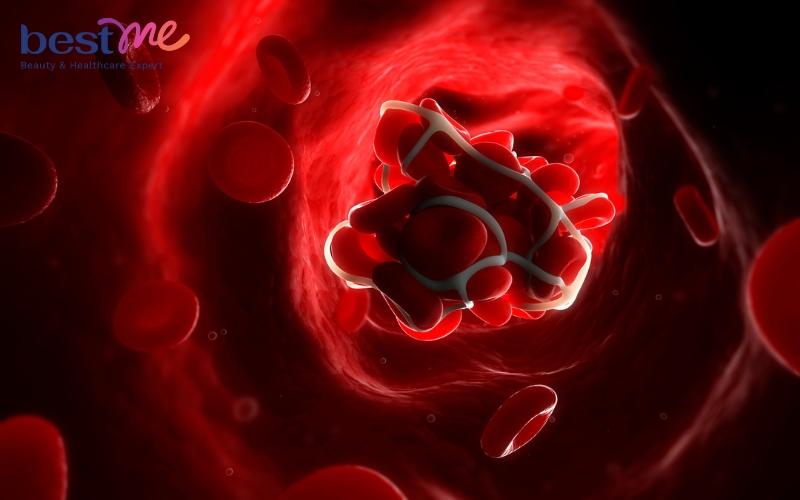 Vitamin K2 tốt cho quá trình đông máu