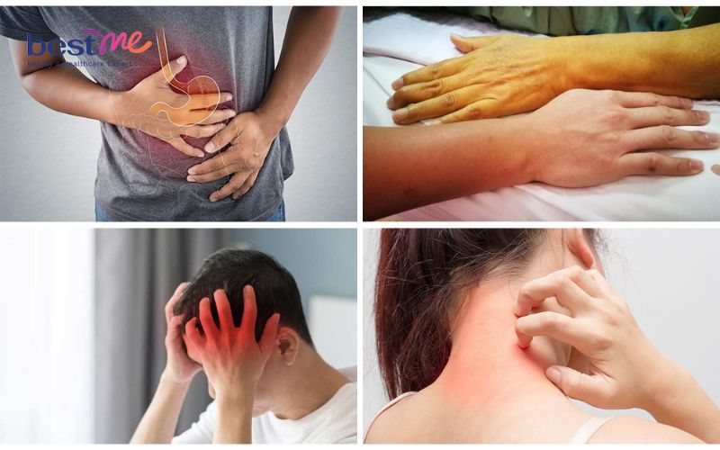 vitamin-pp-500mg-co-cong-dung-gi-co-nen-tu-y-bo-sung-hay-khong-6 Vitamin PP 500mg có công dụng gì? Có nên tự ý bổ sung hay không? - 6