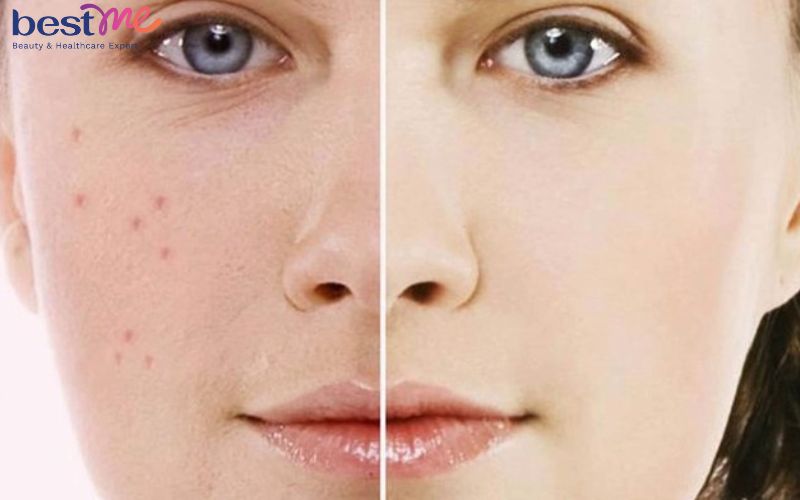 vitamin-pp-nicotinamid-khai-niem-cong-dung-va-lieu-bo-sung-6 Vitamin PP (Nicotinamid): Khái niệm, công dụng và liều bổ sung - 6