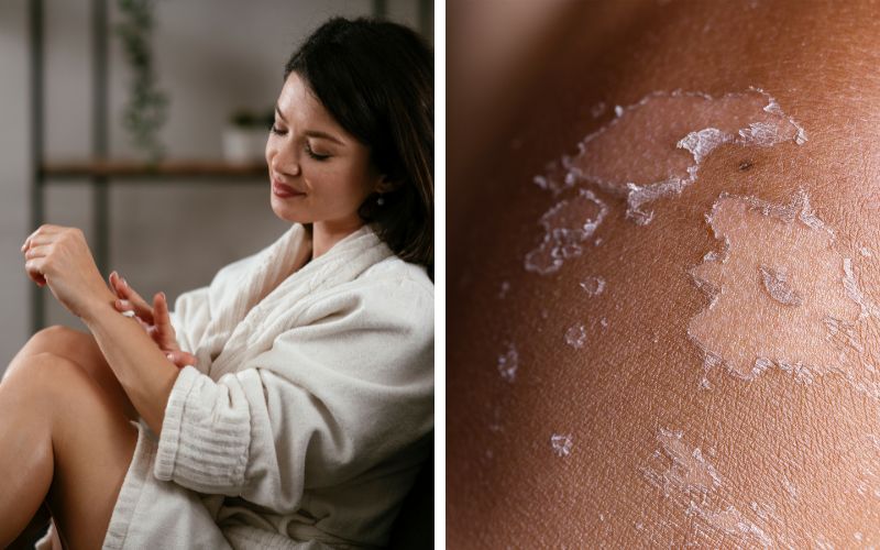 xai-kem-tron-body-co-tot-khong-nhung-rui-ro-tiem-an-ma-chi-em-khong-biet-4 Xài kem trộn body có tốt không? Những rủi ro tiềm ẩn mà chị em không biết - 4