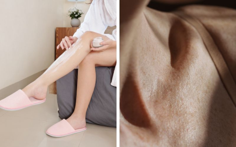 xai-kem-tron-body-co-tot-khong-nhung-rui-ro-tiem-an-ma-chi-em-khong-biet-6 Xài kem trộn body có tốt không? Những rủi ro tiềm ẩn mà chị em không biết - 6