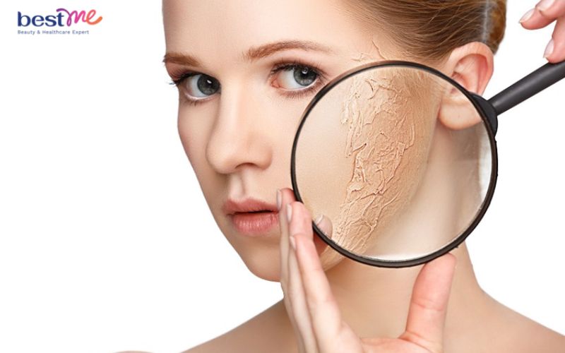 Xịt khoáng có nguy cơ làm khô da